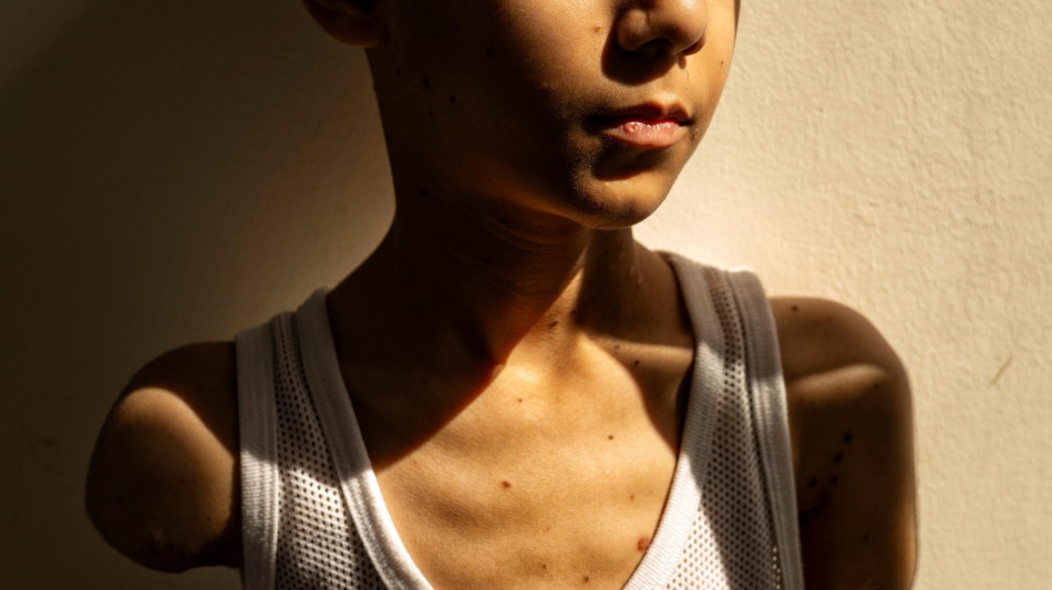 World Press Photo Exhibition, proroga a Torino fino al 14/12