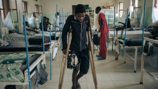 RDC: l&rsquo;h&ocirc;pital de Rutshuru, terminus des combattants bless&eacute;s et des enfants affam&eacute;s