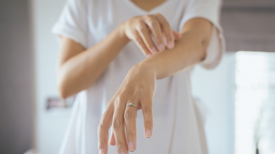 Psoriasi, ok alla rimborsabilit&agrave; per una nuova terapia orale