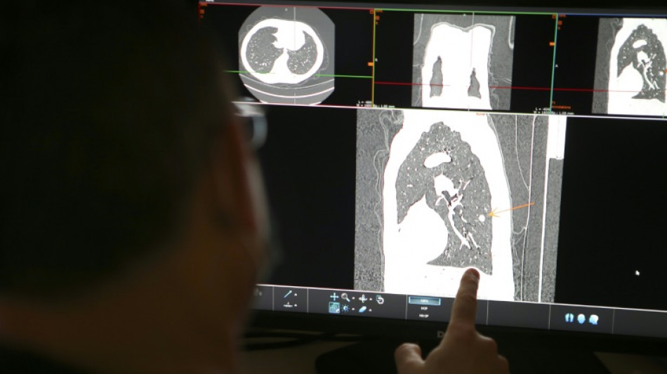 Un comprim&eacute; r&eacute;duit de moiti&eacute; le risque de d&eacute;c&egrave;s d'un type de cancer du poumon