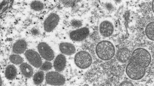 Variole du singe: des sympt&ocirc;mes plut&ocirc;t diff&eacute;rents chez les premiers cas europ&eacute;ens