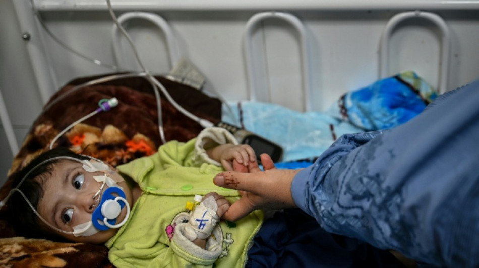 Un mill&oacute;n de ni&ntilde;os podr&iacute;an morir de desnutrici&oacute;n en Afganist&aacute;n, alerta Unicef